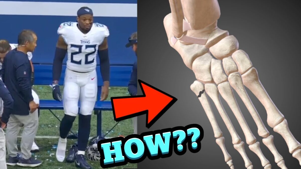 Derrick Henry Injury